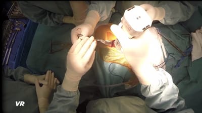 First virtual reality surgery takes you inside the ER